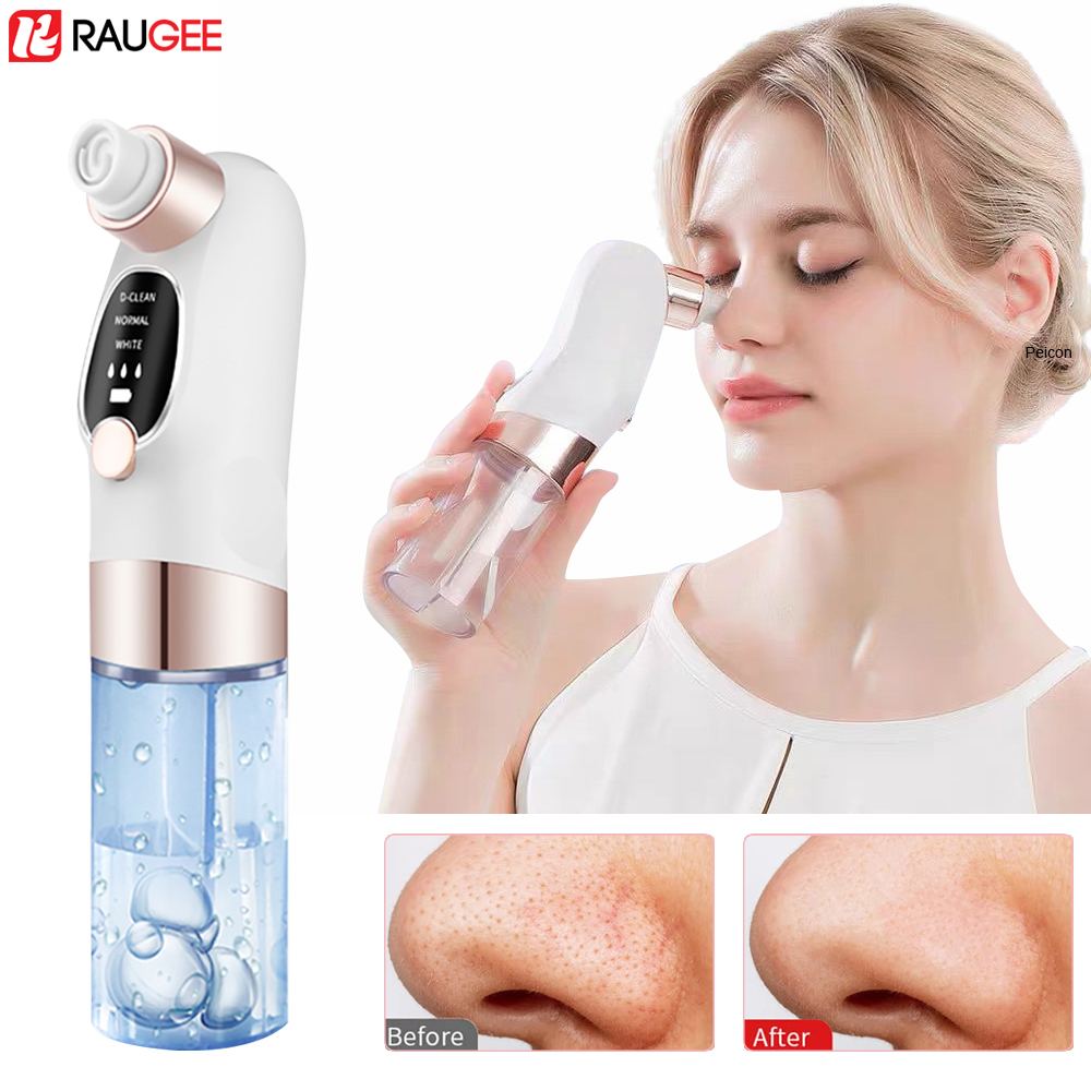 Blackhead Remover Electric Bla - огляд і ціна Nasal Aspirator