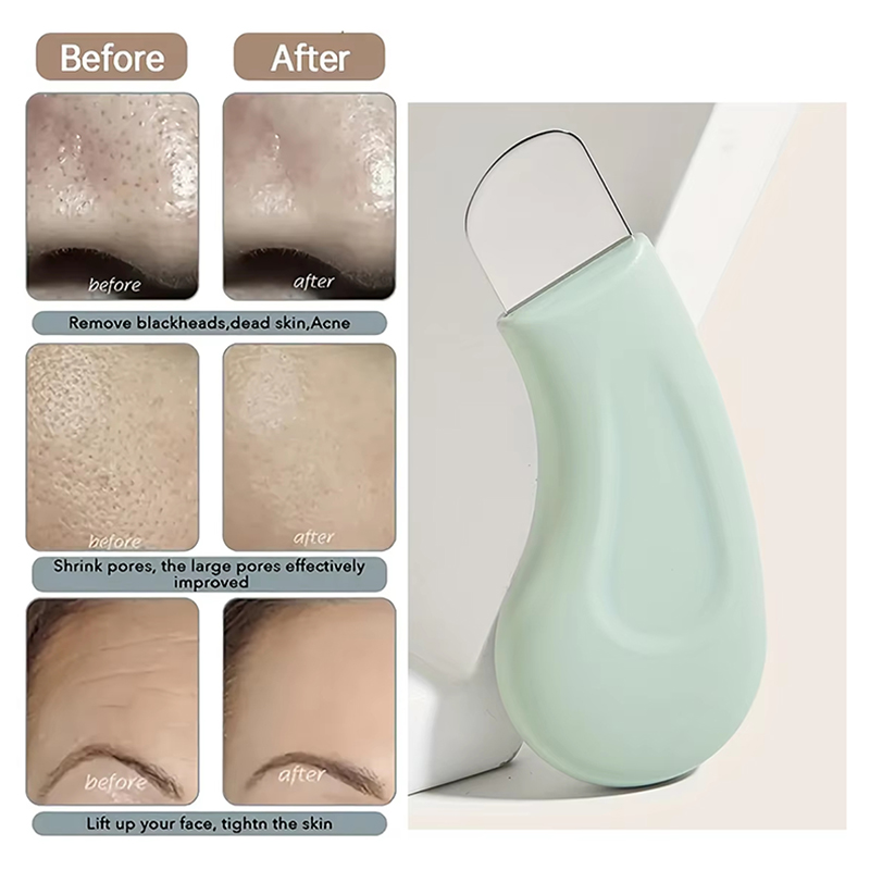 Deep Cleansing Facial Blackhea - огляд і ціна Nasal Aspirator